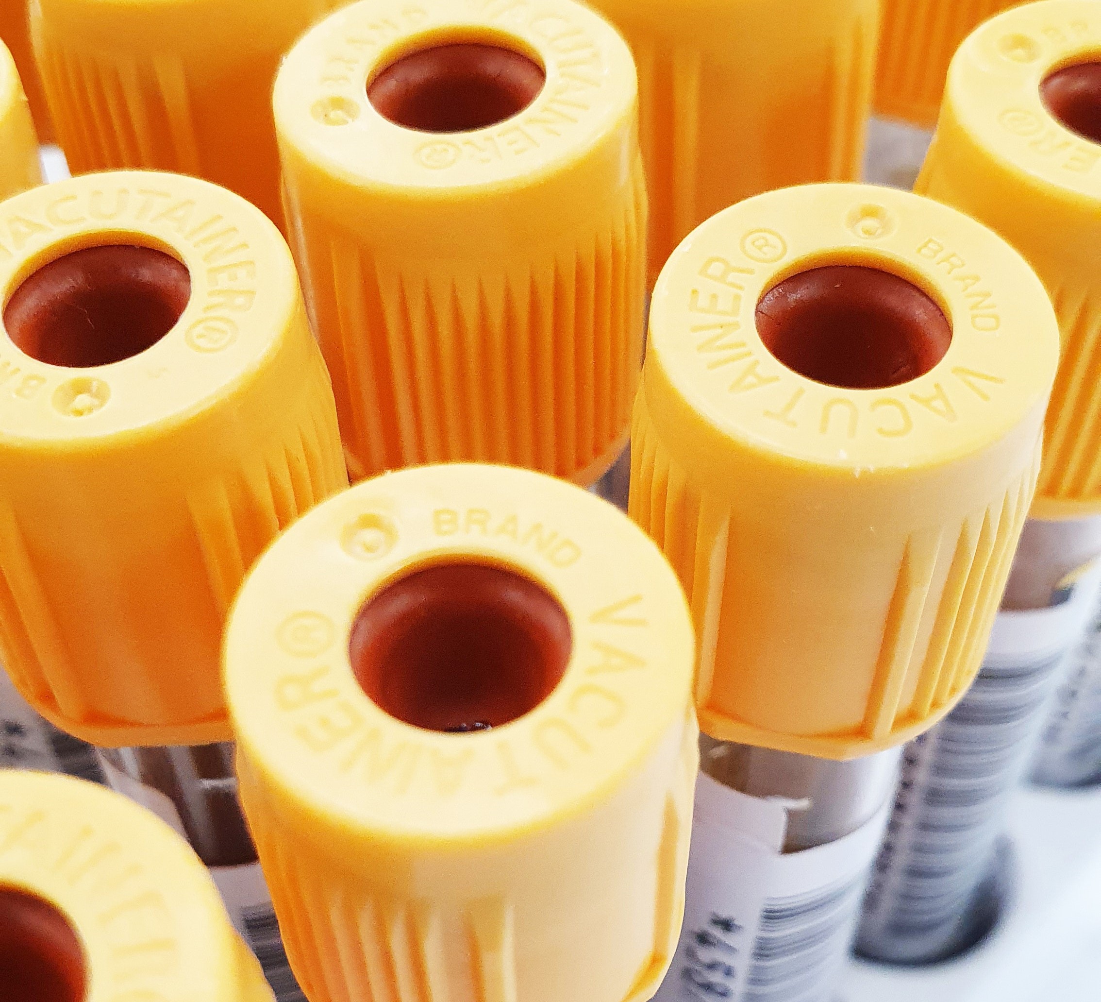 Yellow topped blood testing tubes
