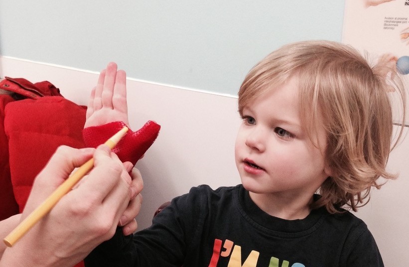 Upper Limb Splinting East London NHS Foundation Trust