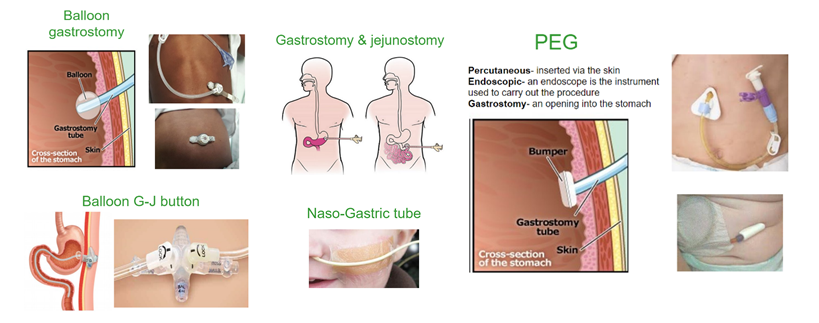 Image banner of enteral devices
