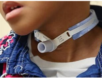 Image of a ventilated child